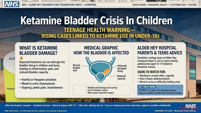 Trẻ 13 tuổi dùng ketamine tổn thương bàng quang mô tả tiểu ra sứa và thủy tinh vỡ